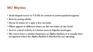 Non epileptiform variants in EEG.pptx