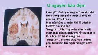 U nguyên bào đệm
Ranh giới rõ ràng nhưng k có vỏ nên khó
khăn trong việc phẫu thuật và tỷ lệ tái
phát sau PT là khá ca
Màu nâu hồng và mềm khá là dễ phân
biệt với nhu mô não
Trung tâm U thường có hoại tử là vì ít
mạch máu đến nuôi dưỡng  sau một tg
thì ổ hoại tử thành nang hóa
Trung tâm u thường chảy máu là do U
phát triển xâm lấn mạch máu gây chảy
máu
 