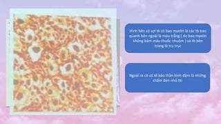 Hình bên có sợi tk có bao myelin là các tb bao
quanh bên ngoài là màu trắng ( do bao myelin
không bám màu thuốc nhuộm ) và tb bên
trong là trụ trục
Ngoài ra cò có tế bào thần kinh đệm là những
chấm đen nhỏ liti
 