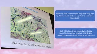 Nhiều sợi thần kinh có myelin cùng chức năng hợp
lại thành một bó. Nhiều bó hợp lại thành dây thần
kinh não tủy
BAO XƠ là bao để bao ngoài dây tk não tủy
BAO LÁ là bao để bao ngoài các bó thần kinh
BAO MYELIN là bao để bao ngoài các sợi thần kinh
 