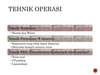 Teknik Temporer:
•Stamm dan Witzel
Teknik Permanen  Janeway
•Keganasan yang tidak dapat dioperasi
•Obstruksi komplit saluran cerna
Teknik PEG (Percutaneus Endoscopic Gastrostomy)
•Trans-oral
•CT-guiding
•Laparoskopi
 