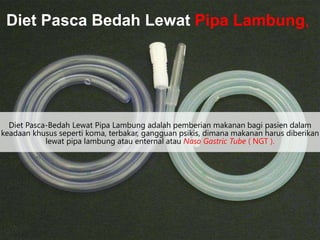 Diet Pasca-Bedah Lewat Pipa Lambung adalah pemberian makanan bagi pasien dalam
keadaan khusus seperti koma, terbakar, gangguan psikis, dimana makanan harus diberikan
lewat pipa lambung atau enternal atau Naso Gastric Tube ( NGT ).
Diet Pasca Bedah Lewat Pipa Lambung,
 