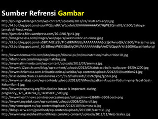 http://youngevityranger.com/wp-content/uploads/2013/07/FruitLady-copy.jpg
http://4.bp.blogspot.com/-sjurMQLsjv0/UW6pefuIs3I/AAAAAAAAA5Y/HjWEZQma8IE/s1600/Bahaya-
Lemak-di-Perut.webp
http://jumielvia.files.wordpress.com/2013/01/gizi1.jpg
http://imagenessss.com/images/wallpapers/kwashiorkor-en-ninos.jpeg
http://3.bp.blogspot.com/-aS9P1MO1Z8I/TtCa8RMMULI/AAAAAAAAASc/1jxFAvvoQlk/s1600/Marasmus.jpg
http://3.bp.blogspot.com/_6CrSBfmzkWE/SGbdlJyC94I/AAAAAAAABpA/nQYdQpplArY/s1600/Kwashiorkor.gi
f
http://www.dermaamin.com/site/images/clinical-pic/m/malnutrition/malnutrition10.jpg
http://doctorven.com/images/gematolog.jpg
http://www.alimmenta.com/wp-content/uploads/2012/07/anemia.jpg
http://www.b12patch.com/blog/wp-content/uploads/2012/02/abstract-balls-wallpaper-1920x1200.jpg
http://www.chrisvitola.com.br/nutricionista/curitiba/wp-content/uploads/2012/04/nutrition21.jpg
http://classconnection.s3.amazonaws.com/592/flashcards/33592/png/goiter.png
http://www.sehataja.com/wp-content/uploads/2013/07/Mendapatkan-Asupan-Yodium-yang-Tepat-Saat-
Kehamilan-3.jpg
http://www.pregnancy.org/files/iodine-intake-is-important-during-
pregnancy_323_434094_0_14085800_500.jpg
http://www.healthnews.com/resources/images/salt.jpg?mw=636&fh=360&oext=png
http://www.tanyadok.com/wp-content/uploads/2008/02/kerdil.jpg
http://myhomesport.ru/wp-content/uploads/2012/10/Vitamina-A.jpg
http://blogs.kcrw.com/goodfood/wp-content/uploads/2013/01/carrots1.jpg
http://www.langlandshealthandfitness.com/wp-content/uploads/2011/11/Help-Scales.jpg
Sumber Refrensi Gambar
 