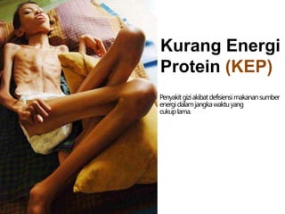 Kurang Energi
Protein (KEP)
Penyakitgiziakibatdefisiensimakanansumber
energidalamjangkawaktuyang
cukuplama.
 
