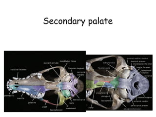 Secondary palate
 