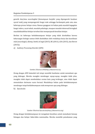 Kegiatan Pembelajaran 3
40
genetik dan/atau neurologikal (kemampuan berpikir yang dipengaruhi keadaan
syaraf otak) yang mempengaruhi fungsi otak sehingga berdampak pada satu atau
beberapa proses belajar siswa. Namun gangguan ini bukan pada masalah kegagalan
fungsi indera, cacat tubuh, masalah psikologis, maupun masalah eksternal.Seringkali
masalahdisabilitas belajar tersebut ikut memperparah kesulitan belajar.
Berikut ini beberapa ketidakmampuan belajar yang tidak disebabkan karena
kekurangan biologis namun lebih disebabkan oleh rendahnya kerja dan koordinasi
otak (neurologis): (Kemp, Smith, & Segal (2015), BC (2011), LDA (2015), dan Berret
(2015)).
a) Auditory Processing Disorder (APD)
Gambar 2Ilustrasi APD(http://ldaamerica.org
Orang dengan APD bukanlah tuli tetapi memiliki hambatan untuk memahami apa
yang didengar. Mereka mungkin mendengar sayup-sayup, mungkin tidak jelas,
mungkin tidak dapat membedakan urutan kata yang terdengar, atau tidak dapat
menentukan darimana suara berasal. Masalahnya bukan pada ketidakmampuan
mendengar tetapi ketidakmampuan otak memproses apa yang didengar.
b) Dyscalculia
Gambar 3Ilustrasi Dyscalculia(http://ldaamerica.org)
Orang dengan ketidakmampuan ini mengalami kesulitan untuk memahami konsep
bilangan dan belajar fakta-fakta matematika. Mereka memiliki pemahaman yang
 