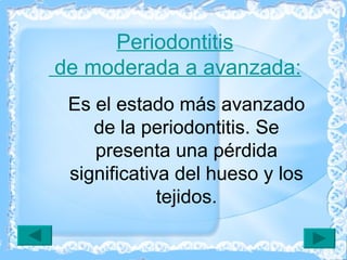 Es el estado más avanzado de la periodontitis. Se presenta una pérdida significativa del hueso y los tejidos. Periodontitis  de moderada a avanzada : 