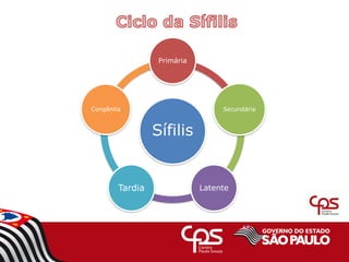 Sífilis
Primária
Secundária
Latente
Tardia
Congênita
 