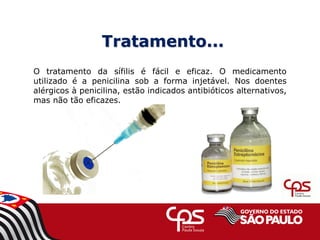 Tratamento...
O tratamento da sífilis é fácil e eficaz. O medicamento
utilizado é a penicilina sob a forma injetável. Nos doentes
alérgicos à penicilina, estão indicados antibióticos alternativos,
mas não tão eficazes.
 