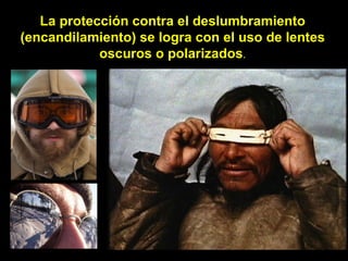 La protección contra el deslumbramiento (encandilamiento) se logra con el uso de lentes oscuros o polarizados . 