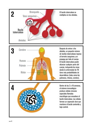 página 42
El bacilo tuberculoso se
multiplica en los alvéolos.
Después de entrar a los
alvéolos, un pequeño número
de bacilos tuberculosos ingresa
al torrente sanguíneo y se
propaga por todo el cuerpo.
El bacilo tuberculoso puede
alcanzar cualquier parte del
cuerpo, incluyendo las áreas
donde la enfermedad de TB
tiene más probabilidades de
desarrollarse (tales como los
pulmones, riñones, cerebro).
Dentro de las 2 a 10 semanas,
el sistema inmunológico
produce células inmunes
especiales llamadas
macrófagos que envuelven al
bacilo tuberculoso. Las células
forman un caparazón duro que
mantiene al bacilo contenido y
bajo control.
Bronquiolo
Vaso sanguíneo
Bacilo
tuberculoso
Alvéolos
Cerebro
Huesos
Pulmón
Riñón
2
3
4
 
