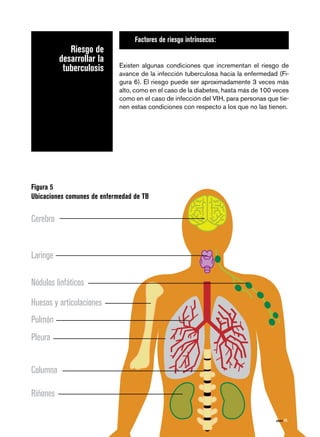 página 45
Riesgo de
desarrollar la
tuberculosis
Factores de riesgo intrínsecos:
Existen algunas condiciones que incrementan el riesgo de
avance de la infección tuberculosa hacia la enfermedad (Fi-
gura 6). El riesgo puede ser aproximadamente 3 veces más
alto, como en el caso de la diabetes, hasta más de 100 veces
como en el caso de infección del VIH, para personas que tie-
nen estas condiciones con respecto a los que no las tienen.
Figura 5
Ubicaciones comunes de enfermedad de TB
Cerebro
Laringe
Nódulos linfáticos
Huesos y articulaciones
Pulmón
Pleura
Columna
Riñones
página 45
 