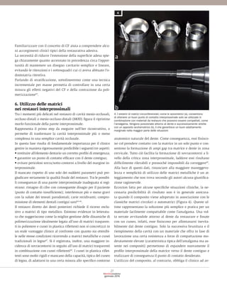 Strumenti di Riempimento Composito Dentale Escavatore Spatola Strumenti di Riempimento Composito Dentale Escavatore Spatola