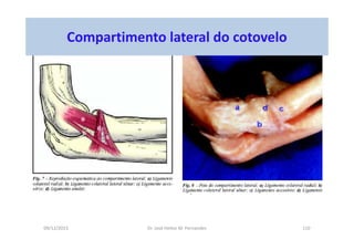 09/12/2015 Dr. José Heitor M. Fernandes 110
Compartimento lateral do cotovelo
 