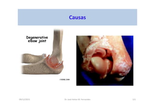 09/12/2015 Dr. José Heitor M. Fernandes 121
Causas
 