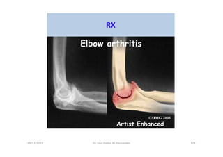 09/12/2015 Dr. José Heitor M. Fernandes 123
RX
 