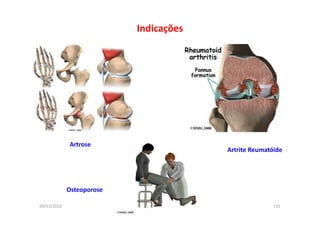 09/12/2015 Dr. José Heitor M. Fernandes 132
Indicações
Artrose
Osteoporose
Artrite Reumatóide
 
