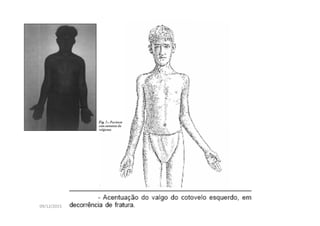 09/12/2015 Dr. José Heitor M. Fernandes
 