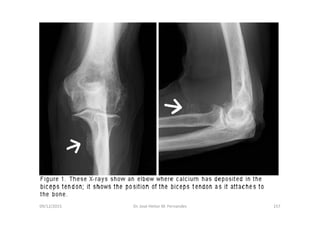 09/12/2015 Dr. José Heitor M. Fernandes 157
 