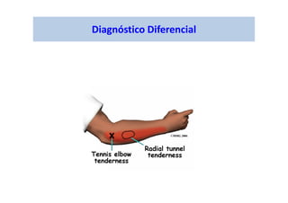 Diagnóstico Diferencial
 