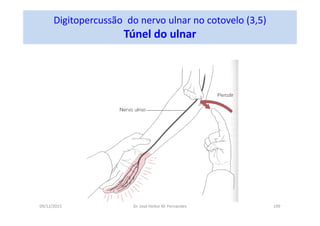 09/12/2015 Dr. José Heitor M. Fernandes 199
Digitopercussão do nervo ulnar no cotovelo (3,5)
Túnel do ulnar
 