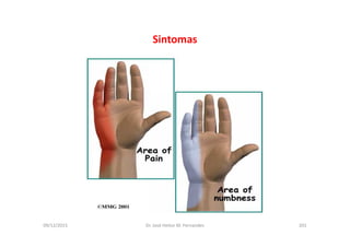 09/12/2015 Dr. José Heitor M. Fernandes 201
Sintomas
 