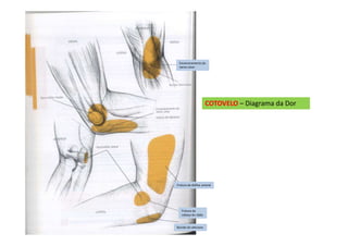 COTOVELO – Diagrama da Dor
Encarceramento do
nervo ulnar
Fratura da diáfise umeral
Fratura da
cabeça do rádio
Bursite do olécrano
 