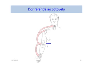 09/12/2015 Dr. José Heitor M. Fernandes 33
Dor referida ao cotovelo
 