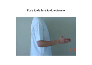Posição de função do cotovelo
 
