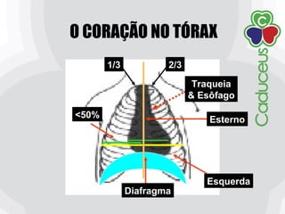 O CORAÇÃO NO TÓRAX
Esterno
Traqueia
& Esôfago
Esquerda
Diafragma
<50%
1/3 2/3
 