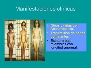 Manifestaciones clínicas 
• Niños y niñas con 
Acondroplasia. 
• Transmisión de genes 
dominantes 
• Estatura baja, 
miembros con 
longitud anormal. 
 