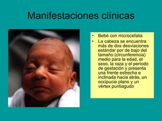 Manifestaciones clínicas 
• Bebé con microcefalia 
• La cabeza se encuentra 
más de dos desviaciones 
estándar por de bajo del 
tamaño (circunferencia) 
medio para la edad, el 
sexo, la raza y el período 
de gestación y presenta 
una frente estrecha e 
inclinada hacia atrás, un 
occipucio plano y un 
vértex puntiagudo 
 