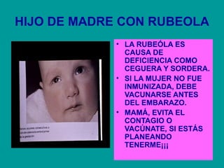HIJO DE MADRE CON RUBEOLA 
• LA RUBEÓLA ES 
CAUSA DE 
DEFICIENCIA COMO 
CEGUERA Y SORDERA. 
• SI LA MUJER NO FUE 
INMUNIZADA, DEBE 
VACUNARSE ANTES 
DEL EMBARAZO. 
• MAMÁ, EVITA EL 
CONTAGIO O 
VACÚNATE, SI ESTÁS 
PLANEANDO 
TENERME¡¡¡ 
 