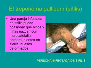 El treponema pallidum (sífilis) 
• Una pareja infectada 
de sífilis puede 
ocasionar que niños y 
niñas nazcan con 
hidrocafefalia, 
sordera, dientes en 
sierra, huesos 
deformados 
PERSONA INFECTADA DE SIFILIS 
 