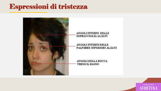 Espressioni di tristezza
91
 