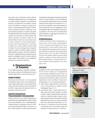 TEMA FARMACIA - Gennaio 2017
371MODULO DIDATTICO
rammentare che le complicazioni settiche delle fasi
iniziali della malattia (stadio acuto), come quelle tardive
non settiche risultano ugualmente e potenzialmente
rischiose, al pari delle forma di scarlattina a esordio
acuto ed ecclatante con sviluppo di esantema più
intenso, come precedentemente descritto. Pertanto,
anche la copertura antibiotica e antipiretica, come
pure la terapia di supporto non possono discostarsi
da quelle descritte per la forma classica di scarlattina.
L’esordio può comparire con sintomi generici quali
cefalea, anoressia, sonnolenza, seguiti da una
eruzione diffusa di colore rosa che scompare dopo
4-5 giorni, lasciando una fine desquamazione,
che può durare alcune settimane. La primavera
e l’estate sono i periodi preferiti d’esordio della
IV malattia. In caso di eziologia virale, la terapia di
supporto consiste nel controllo e gestione del rialzo
della temperatura corporea, nel favorire l’idratazione,
offrendo con regolarità bevande zuccherate al piccolo
paziente e privilegiando alimenti morbidi e gradevoli
(yogurt, gelato, frutta e frullati) in caso di svogliatezza
alimentare e di mucosite in cavità orale.
6. Megaloeritema
(V malattia)
È una malattia esantematica dell’infazia autolimitan-
tesi, benigna e costituisce la manifestazione clinica più
frequente della infezione umana da Parvovirus B19.
CENNI STORICI
Descritta già nel XVII secolo, come una possibile
manifestazione della rosolia, la sua identificazione
come malattia esantematica a parte è della fine del
1800 e la sua denominazione come eritema infettivo
del 1899. L’origine virale fu dimostrata nel 1984, con
l’isolamento del Parvovirus B19.
AGENTE EZIOLOGICO,
TRASMISSIONE E INCUBAZIONE
Il Parvovirus B19 è un virus a DNA, appartenente al
genere Erythrovirus della famiglia Parvoviridae. Si tratta
diunviruscheinfettasolol’uomoeinparticolarelalinea
midollare eritroide. La trasmissione varia dal 15-30%
dei contatti sensibili nelle famiglie e nei nosocomi, al
60% a livello scolastico e avviene tramite goccioline
aereosolicheperviarespiratoria.Ilperiododiincubazione
varia da 4 a 28 giorni (media 16-17 giorni). Sebbene la
via di contagio sia quella respiratoria, il virus può essere
trasmesso tramite sangue ed emoderivati. Da 7 a 11
giorni dopo l’inoculazione, il virus invade il sangue e la
viremia precede sia il rash nel megaloeritema, che le
crisi aplastiche nelle forme ematologiche (vedi dopo).
In gravidanza, il Parvovirus B19 può attraversare la
barriera placentare e raggiungere il feto durante una
infezione materna primaria.
EPIDEMIOLOGIA
L’infezione da Parvovirus B19 è estremamente co-
mune in tutto il mondo. Il tasso di sieropositività è
5-10% tra i bambini di età compresa tra 2-5 anni e
aumenta al 50% a 15 anni e a 60% a 30 anni, fino al
90% negli adulti di età superiore ai 60 anni. Il tasso di
sieroconversione annuale tra le donne gravide senza
Parvovirus B19 è 1,5%. I casi clinici di infezione da
Parvovirus B19 (Eritema infettivo) possono essere
sporadici o verificarsi in focolai in tardo inverno fino
all’inizio della primavera. Un aumento ciclico del nu-
mero di infezioni è anche osservato, con un picco
ogni 3-4 anni.
SINTOMI
In soggetti normali e immunocompetenti, il Parvovirus
B19 ha minima morbilità, con il megaloeritema
come principale manifestazione clinica. Dopo una
lieve e non sempre distinguibile fase prodromica
caratterizzata da febbricola, cefalea e lievi sintomi
respiratori alti, il rash si manifesta in tre fasi che si
sovrappongono e non sono sempre distinguibili:
1.	 stadio iniziale è quello dell’eritema facciale rosso
fuoco, che dà al bambino un aspetto a ‘guance
schiaffeggiate’ (Figure 13, 14);
2.	 seconda fase, (dopo 1-4 giorni dall’eruzione fac-
ciale), nella quale i pazienti sviluppano un eritema
maculare; in seguito si assiste al rapido schiarimento
centrale, con aspetto reticolato a merletto o ortica-
rioide soprattutto al tronco e alle superfici estensorie
delle estremità prossimali, con risparmio del palmo
delle mane e della pianta dei piedi (Figure 15, 16);
3.	 terza fase, in cui l’esantema ricorre a intermittenza
in risposta agli stimoli, come irritazione locale, alte
temperature e stress emotivo per 1-3 settimane.
Figura 14. Eritema facciale in corso di
megaloeritema infettivo
(Fonte: Dott. F.C.Gamaleri)
Figura 13. Eritema facciale in corso di
megaloeritema infettivo
(Fonte Dott.ssa Lucia Restano)
 