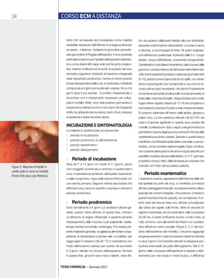 28 CORSO ECM A DISTANZA
TEMA FARMACIA - Gennaio 2017
tanto che nel passato era considerato come malattia
inevitabile nel periodo dell’infanzia. Il contagio avviene per
via aerea – inalatoria, mediante le goccioline aerosoliz-
zate (goccioline di Flugge) dell’espirato. Il virus possiede
particolare tropismo per l’epitelio dell’apparato respirato-
rio e come diversi altri ceppi virali, anche per la congiun-
tive; insieme costituiscono le porte di accesso del virus
nel nostro organismo. Il periodo di massima contagiosità
cade nel periodo prodromico, mentre è minore durante
la fase desquamativa della cute. In particolare, l’infettività
corrisponde ai 3 giorni prima del rash cutaneo, fino a 4-6
giorni dopo il suo esordio. Il contatto interpersonale o
ravvicinato non è strettamente necessario per svilup-
pare il morbillo; infatti, virus vitali possono permanere in
sospensione nell’aria anche un’ora dopo che il paziente
infetto ha abbandonato la stanza, tanto che lo sviluppo
di epidemie è estremamente rapido.
INCUBAZIONEESINTOMATOLOGIA
La malattia è caratterizzata da diverse fasi:
■■ periodo di incubazione
■■ periodo prodromico (o dell’enantema)
■■ periodo esantematico
■■ periodo desquamativo
■■ Periodo di incubazione
Varia da 7 a 14 giorni (in media 9-11 giorni), senza
che il soggetto avverta alcun sintomo; in questa fase il
virus, in precedenze penetrato dall’epitelio respiratorio
o dalle congiuntive, migra nelle stazioni linfonodali con
una viremia primaria. Segue la viremia secondaria che
diffonde il virus verso le superfici corporee e anticipa il
periodo prodromico.
■■ Periodo prodromico
Dura normalmente 3-4 giorni. Le condizioni cliniche ge-
nerali, quanto meno all’inizio di questa fase, mimano
un’affezione di origine influenzale. Il paziente lamenta
interessamento delle mucose oculo-palpebrali, nasale,
laringo-tracheo-bronchiale, orofaringea. Può essere pre-
sentemalesseregenerale,svogliatezzaalimentareoinap-
petenza; la temperatura corporea sale «a scaletta» per
raggiungere il massimo (39-40 °C) in coincidenza con
l’inizio dell’eruzione cutanea, per svanire nei successivi
2-3 giorni, talvolta con brusca defervescenza. Sempre
in questa fase, gli occhi sono rossi e dolenti, viene rife-
rito dai pazienti collaboranti fastidio alla luce (fotofobia),
associata a lacrimazione abbondante. La tosse è secca
e stizzosa, e accompagna la rinite. Gli autori anglosas-
soni definiscono questa fase «il periodo delle 3 c»: cough
(tosse), coryza (raffreddore), conjuntivitis (congiuntivite).
Caratteristicoepeculiareèl’enantema:sullamucosadelle
guance in corrispondenza dei denti premolari inferiori (tal-
voltaanchesuperiori)sipossonoosservarepochielementi
(5-10),grandicomelacapocchiadiunospillo,concentro
bianco-azzurrognolo (che corrisponde a una zona di ne-
crosi) e alone rosso circostante, che danno l’impressione
diuna tenuespruzzatadicalce sullamucosa arrossata;si
trattadelle«macchiediKoplik».(Figura2)Essesonomolto
fugacinelloroaspettoclassico(in12-18orecompaionoe
scompaiono) e lasciano il posto a sole chiazze arrossate.
Si possono estendere all’interno delle labbra, gengive e
palato duro. La loro presenza (rilevata nel 50-70% dei
casi) è di grande significato in quanto sono proprie del
morbillo (costituiscono tipico segno patognomonico) e
permettonodiporrediagnosiancorprima(24-48ore)della
caratteristica eruzione cutanea. Sempre in questa fase si
manifesta una linfoadenopatia latero-cervicale e pre-au-
ricolare, come pure lieve splenomegalia. Dopo una lieve,
non costante attenuazione dei sintomi sopra descritti con
possibile modesta discesa della febbre, in 4°-5° giornata,
si assiste a brusco rialzo della temperatura corporea che
coincide con l’inizio del successivo periodo.
■■ Periodo esantematico
L’esantema cutaneo, espressione dell’infezione delle cel-
lule epiteliali da parte del virus, si manifesta con lesioni
all’inizio pianeggianti (macule), successivamente a rilievo
(papule) dai contorni irregolari, che possono confluire in
grandi macchie (maculo-papule), non pruriginose. Il co-
lorito varia dal rosa al rosso vivo; all’inizio si localizzano
alla radice dei capelli, sulla fronte, dietro le orecchie (in
regione mastoidea), per poi estendersi nelle successive
24-36 ore, in parte confluendo tra loro, a tutto il viso, al
collo, al tronco, sino alle estremità inferiori con caratteri-
stica diffusione cranio-caudale. (Figure 3, 4, 5: fasi evo-
lutive dell’esantema del morbillo). L’eruzione raggiunge
progressivamente in ciascuna area la massima intensità
in circa 3 giorni. Con l’esordio del rash si sviluppa la pro-
duzione anticorpale da parte dell’organismo. Nel 4°-5°
giorno dalla comparsa dell’esantema si assiste a sfeb-
bramento per crisi (ossia in modo brusco, a differenza
Figura 2. Macchie di Koplik in
cavità orale in corso di morbillo
(Fonte Dott.ssa Lucia Restano)
 
