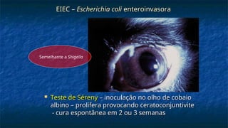  Teste de Séreny
Teste de Séreny – inoculação no olho de cobaio
– inoculação no olho de cobaio
albino – prolifera provocando ceratoconjuntivite
albino – prolifera provocando ceratoconjuntivite
- cura espontânea em 2 ou 3 semanas
- cura espontânea em 2 ou 3 semanas
EIEC –
EIEC – Escherichia coli
Escherichia coli enteroinvasora
enteroinvasora
Semelhante a Shigella
 