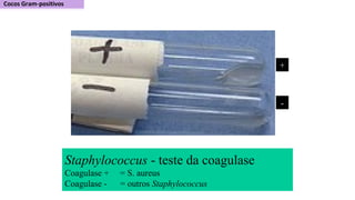 +
-
Staphylococcus - teste da coagulase
Coagulase + = S. aureus
Coagulase - = outros Staphylococcus
 