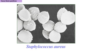 Staphylococcus aureus
 