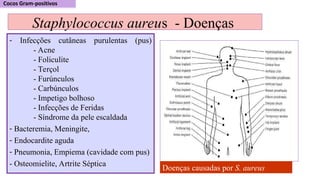 Staphylococcus aureus - Doenças
- Infecções cutâneas purulentas (pus)
- Acne
- Foliculite
- Terçol
- Furúnculos
- Carbúnculos
- Impetigo bolhoso
- Infecções de Feridas
- Síndrome da pele escaldada
- Bacteremia, Meningite,
- Endocardite aguda
- Pneumonia, Empiema (cavidade com pus)
- Osteomielite, Artrite Séptica
Doenças causadas por S. aureus
 