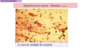 S. aureus isolado de escarro
Staphylococcus aureus - Doenças (continuação)
 