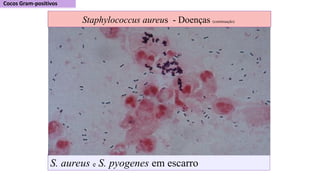 S. aureus e S. pyogenes em escarro
Staphylococcus aureus - Doenças (continuação)
 