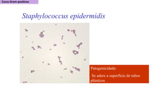 Staphylococcus epidermidis
Patogenicidade:
Se adere a superfície de tubos
plásticos
 