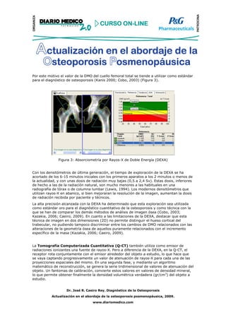 Por este motivo el valor de la DMO del cuello femoral total se tiende a utilizar como estándar
para el diagnóstico de osteoporosis (Kanis 2000; Cobo, 2003) (Figura 3).




               Figura 3: Absorciometría por Rayos-X de Doble Energía (DEXA)


Con los densitómetros de última generación, el tiempo de exploración de la DEXA se ha
acortado de los 6-15 minutos iniciales con los primeros aparatos a los 2 minutos o menos de
la actualidad, y con unas dosis de radiación muy bajas (0,5 a 2,4 Sv). Estas dosis, inferiores
de hecho a las de la radiación natural, son mucho menores a las habituales en una
radiografía de tórax o de columna lumbar (Lewis, 1994). Los modernos densitómetros que
utilizan rayos-X en abanico, si bien mejoraran la resolución de la imagen, aumentan la dosis
de radiación recibida por paciente y técnicos.
La alta precisión alcanzada con la DEXA ha determinado que esta exploración sea utilizada
como estándar oro para el diagnóstico cuantitativo de la osteoporosis y como técnica con la
que se han de comparar los demás métodos de análisis de imagen ósea (Cobo, 2003;
Kazakia, 2006; Caeiro, 2009). En cuanto a las limitaciones de la DEXA, destacar que esta
técnica de imagen en dos dimensiones (2D) no permite distinguir el hueso cortical del
trabecular, no pudiendo tampoco discriminar entre los cambios de DMO relacionados con las
alteraciones de la geometría ósea de aquellos puramente relacionados con el incremento
específico de la masa (Kazakia, 2006; Caeiro, 2009).


La Tomografía Computerizada Cuantitativa (Q-CT) también utiliza como emisor de
radiaciones ionizantes una fuente de rayos-X. Pero a diferencia de la DEXA, en la Q-CT, el
receptor rota conjuntamente con el emisor alrededor del objeto a estudio, lo que hace que
se vaya captando progresivamente un valor de atenuación de rayos-X para cada una de las
proyecciones espaciales del mismo. En una segunda fase, y mediante un algoritmo
matemático de reconstrucción, se genera la serie tridimensional de valores de atenuación del
objeto. Un fantomas de calibración, convierte estos valores en valores de densidad mineral,
lo que permite obtener finalmente la densidad volumétrica verdadera (gr/cm3) del objeto a
estudio.


                    Dr. José R. Caeiro Rey. Diagnóstico de la Osteoporosis
           Actualización en el abordaje de la osteoporosis posmenopáusica, 2009.
                                   www.diariomedico.com
 