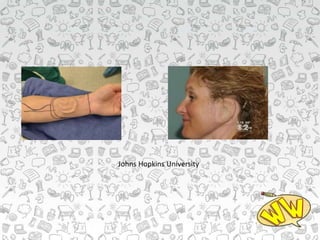 Johns Hopkins University
 