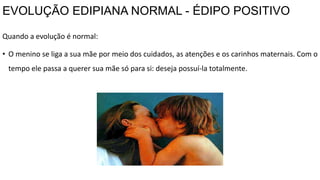 EVOLUÇÃO EDIPIANA NORMAL - ÉDIPO POSITIVO
Quando a evolução é normal:
• O menino se liga a sua mãe por meio dos cuidados, as atenções e os carinhos maternais. Com o
tempo ele passa a querer sua mãe só para si: deseja possuí-la totalmente.
 