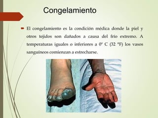 Congelamiento
 El congelamiento es la condición médica donde la piel y
otros tejidos son dañados a causa del frío extremo. A
temperaturas iguales o inferiores a 0º C (32 °F) los vasos
sanguíneos comienzan a estrecharse.
 
