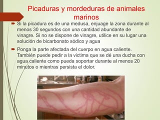 Picaduras y mordeduras de animales
marinos
 Si la picadura es de una medusa, enjuage la zona durante al
menos 30 segundos con una cantidad abundante de
vinagre. Si no se dispone de vinagre, utilice en su lugar una
solución de bicarbonato sódico y agua
 Ponga la parte afectada del cuerpo en agua caliente.
También puede pedir a la victima que se dé una ducha con
agua caliente como pueda soportar durante al menos 20
minutos o mientras persista el dolor.
 