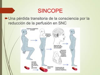 SINCOPE
Una pérdida transitoria de la consciencia por la
reducción de la perfusión en SNC
 